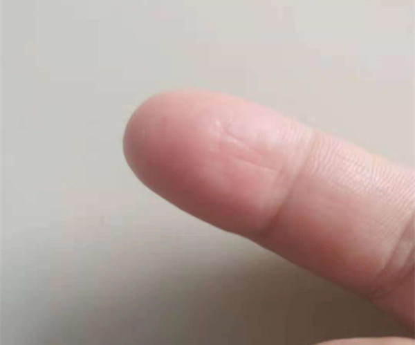 指纹